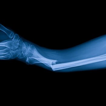 Our Expertise in Orthopedic Billing & Coding